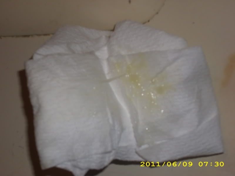 Clear Mucus Plug